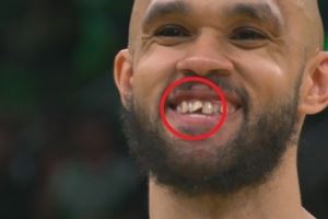 小白谈去年总决赛被打门牙：之后我进了三分 是我最美好回忆之一